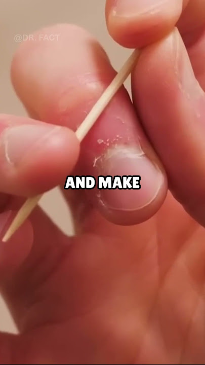 How To Throw Toothpicks😨