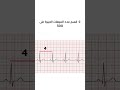 كيف ممكن نحسب ال   على ورقة ال   