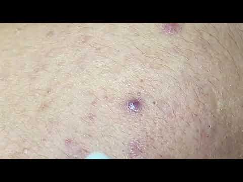 Video Relax With Hien Nguyen Spa #678 - youtube