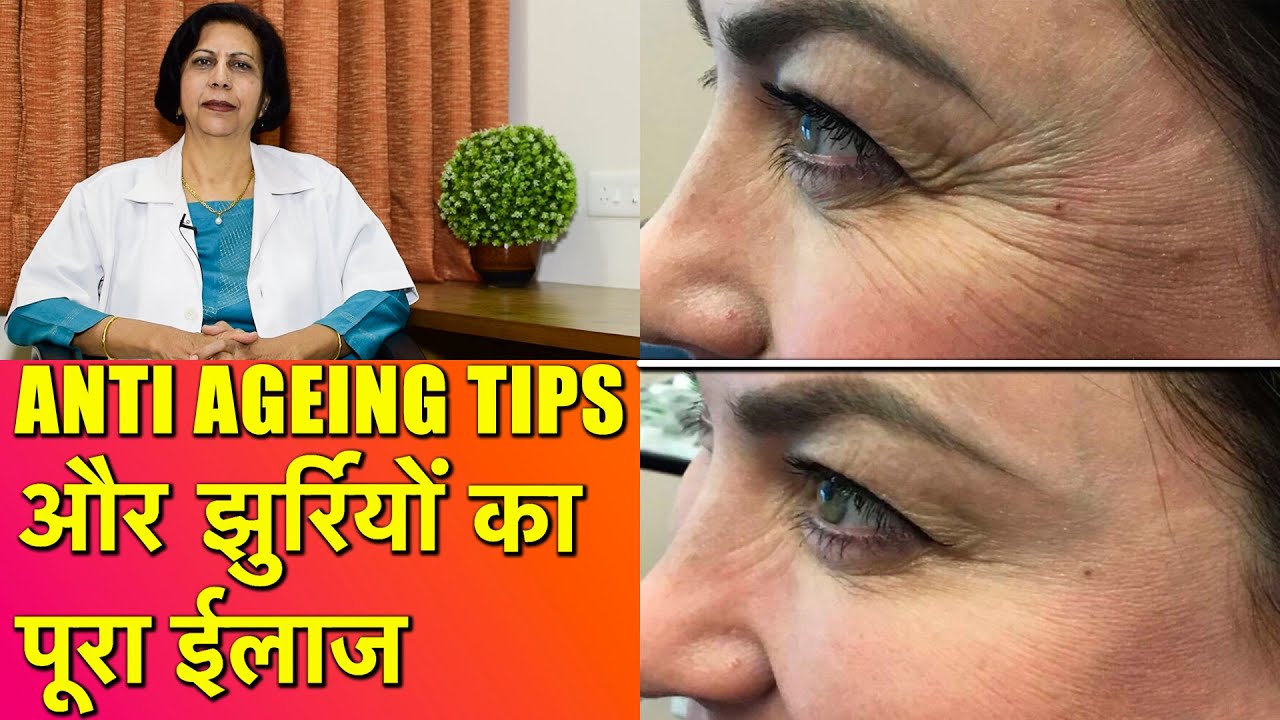झुर्रियों का सही और सरल ईलाज || Anti Ageing Tips & Treatment of Wrinkles & Fine Lines