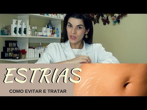 Vídeo: Estrias Nas Costas: Causas, Sintomas E Tratamento