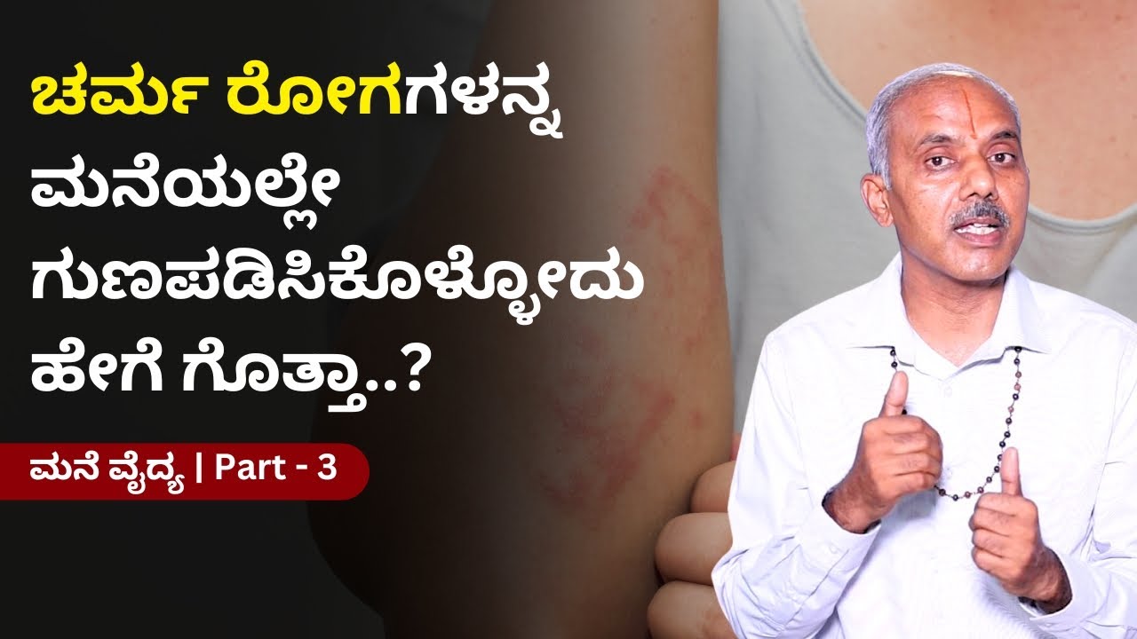 ಚರ್ಮ ರೋಗಗಳನ್ನ ಮನೆಯಲ್ಲೇ ಗುಣಪಡಿಸಿಕೊಳ್ಳೋದು ಹೇಗೆ ಗೊತ್ತಾ..? | ಮನೆ ವೈದ್ಯ । Part - 3|Mane Vaidya|