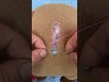 Sock mending tips #needleworktips #needleandthread