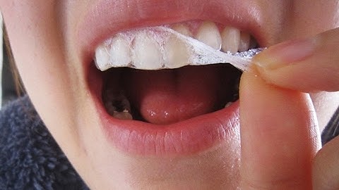 Cách dùng miếng dán làm trắng răng crest 3d white whitestrips