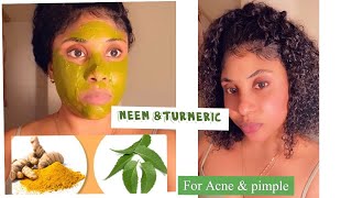 Neem & Turmeric face mask for acne & pimples/neem ak safran mask pou tach ak bouton