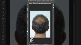 علاج الصلع بالفوتوشوب (Adding Hair By Photoshop)