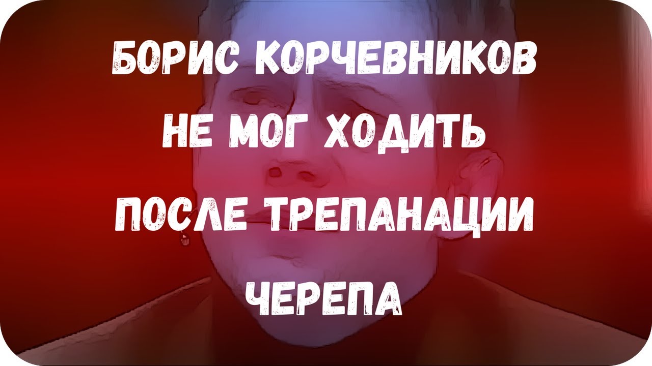 ⁣Борис Корчевников не мог ходить после трепанации черепа