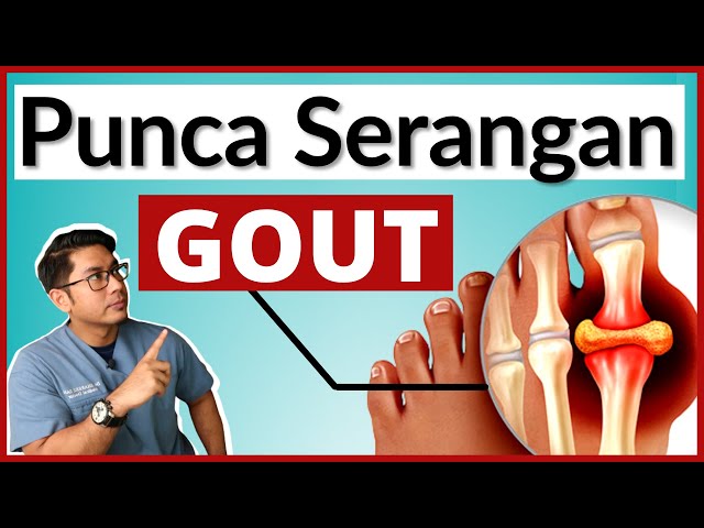 5 Makanan Punca Serangan Gout | Uric Acid Tinggi | Doctor Sani | class=