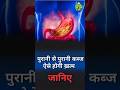 Migraine, Acne, Gas &amp; Constipation? Kabj Dafa Explained | ⁨@VedicUpchar⁩ | Anil Bansal | #shorts