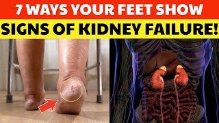 7 Toxic Signs of Kidney Failure Showing Up in Your Feet (No. 5 Is Sneaky!) |Senior Wellness Hub