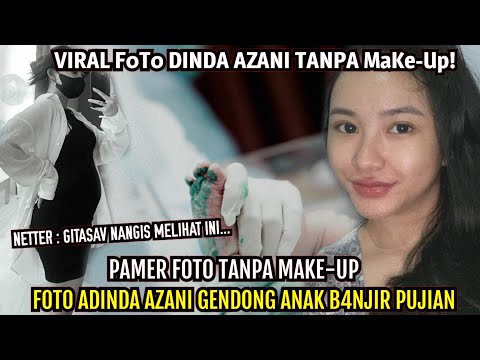 Pamer Muka Tanpa Makeup! Foto Adinda Azani Gendong Anak B4njir Pujian...