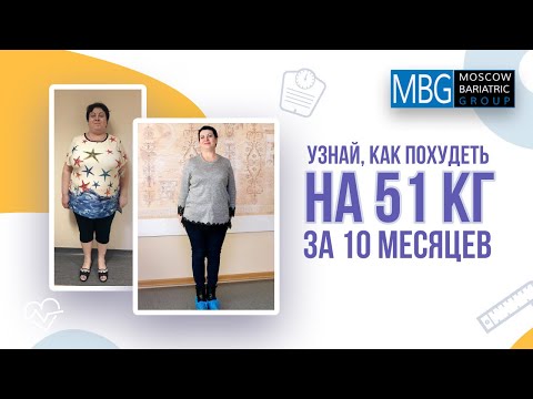 Минус 51 кг за 10 месяцев | Отзыв после рукавной гастропластики