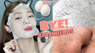 DIY Blackhead/Whitehead Remover Peel Off Mask (ITLOG & TISSUE LANG!) | Lizzy Abujan