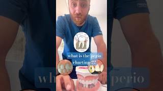 What is perio charting  And periodontal pocket