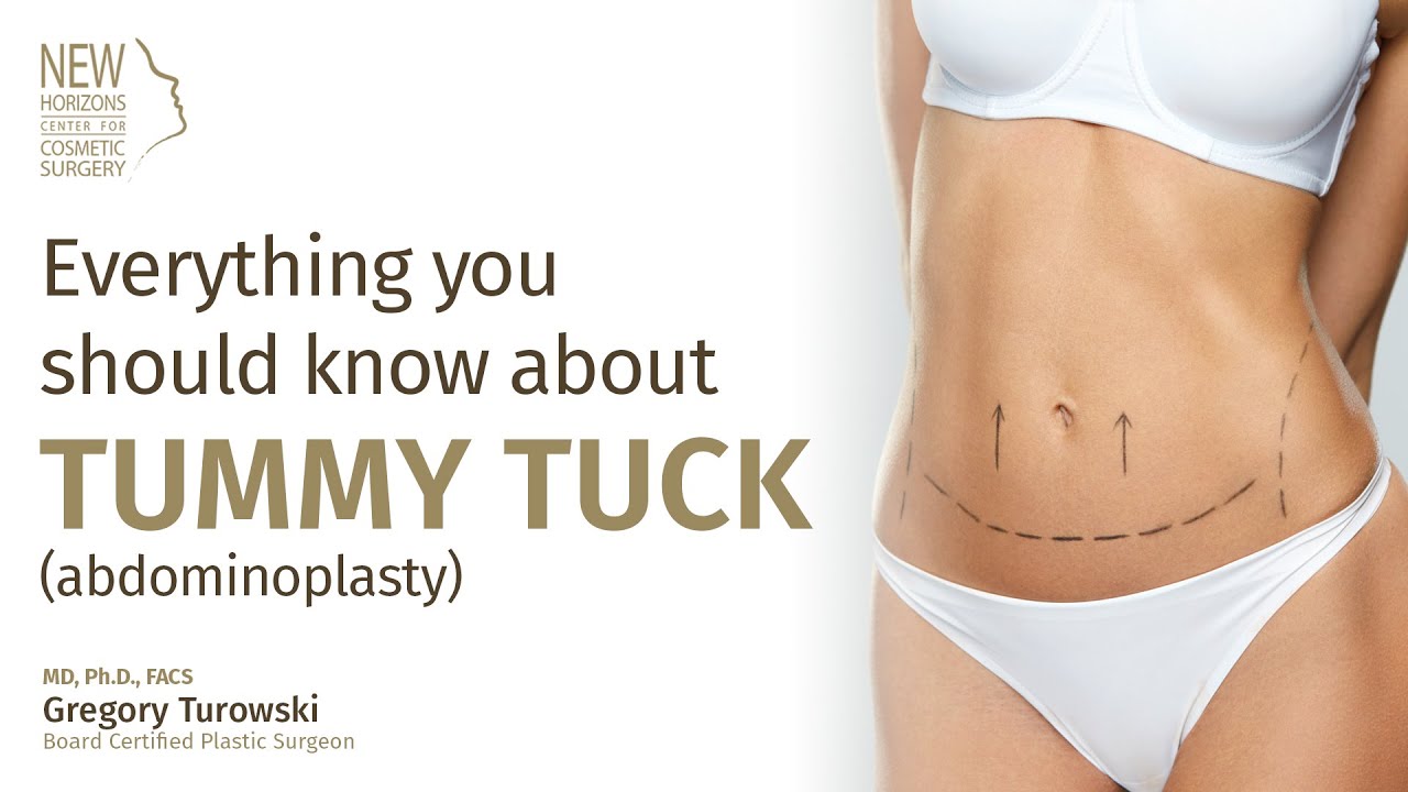 Will I Need a Tummy Tuck After Taking Semaglutides? | New Horizons Will I Need a Tummy Tuck After Taking Semaglutides? | New Horizons