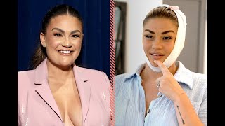 Big Heartbreaking😭News |Brittany Cartwright Chin & Lip ‘Back To Normal’ Post-Surgery,
