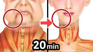 20minsAntiAging Face Lift Exercise for Jowls, Laugh Lines, Slim Jawline!