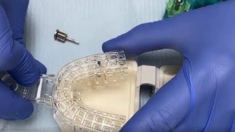 Dental Implant Impressions Analog Technique Osstem