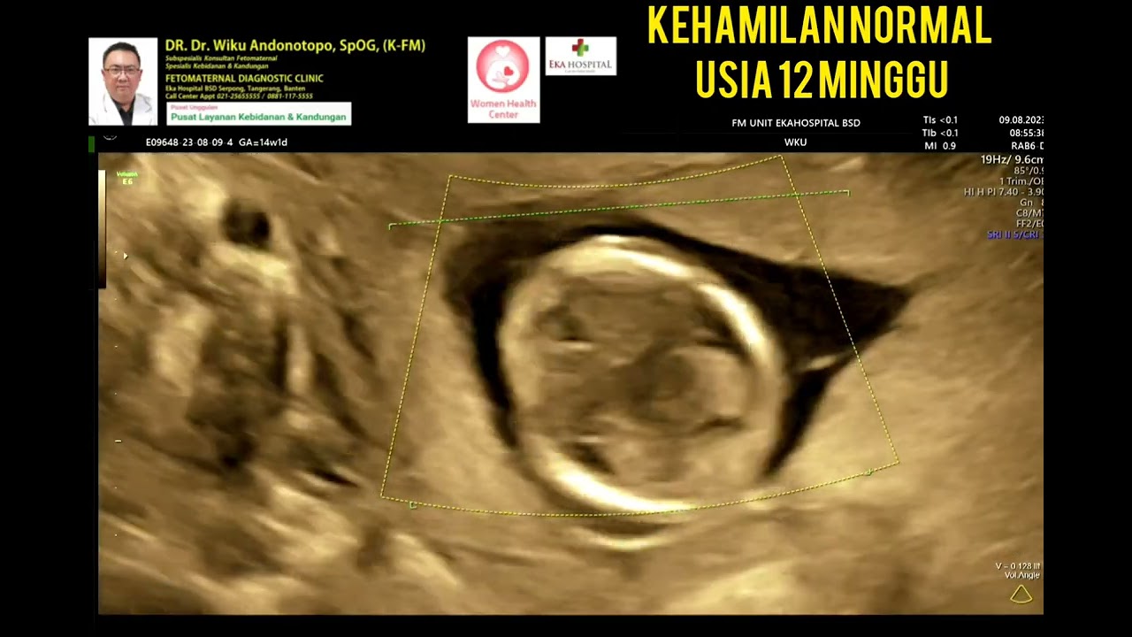 Kehamilan 12 minggu normal