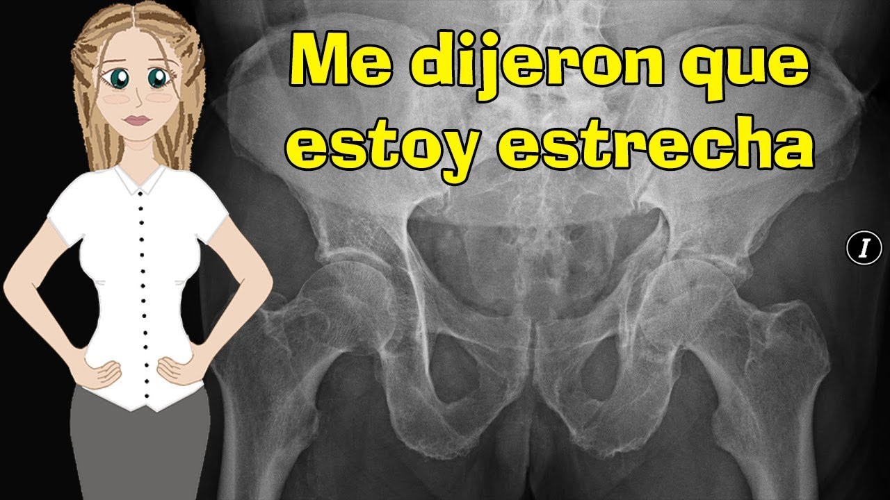 Me dijeron que estoy estrecha / cómo se si puedo tener a mi bebé por parto YouTube