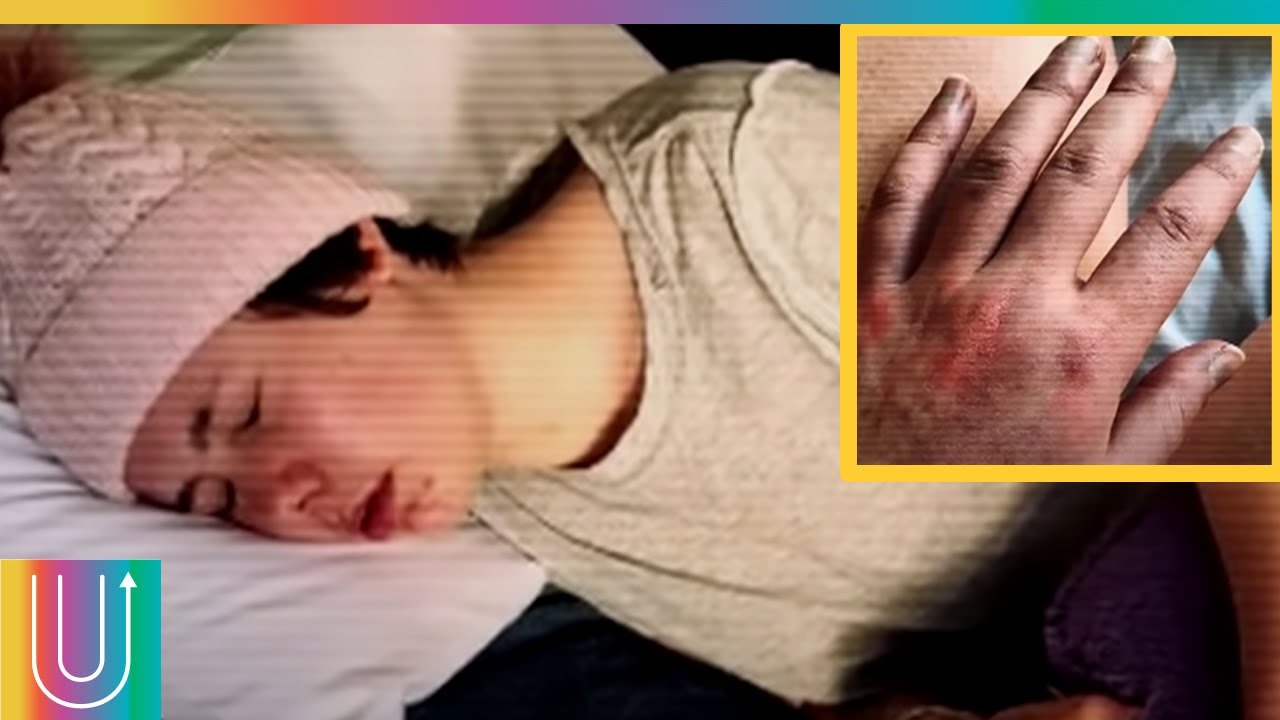 Joven vive sintiendo que el aire le quema la piel YouTube Joven vive sintiendo que el aire le quema la piel YouTube