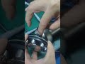 Install the handle cap