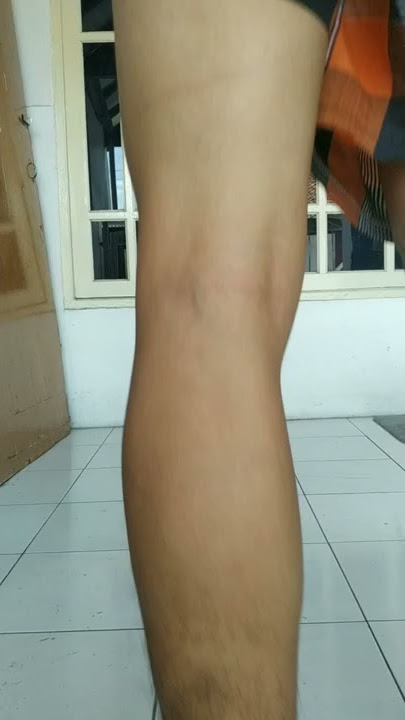 GINI CARA CEK VARISES SENDIRI ! - TES TNI