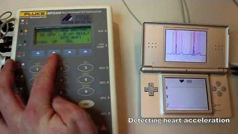 A Real-Time Wavelet-Based Electrocardiogram Delineation System