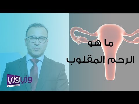 فيديو: هل يمكن أن يؤذيك مقلوب الموضع؟