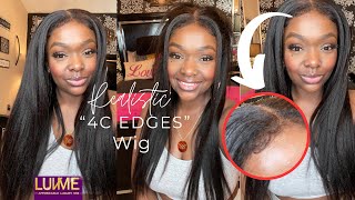 4C Kinky Edges Natural Hairline | Beginner Friendly | 5X5 Closure | Hd Lace| Luvme Hair