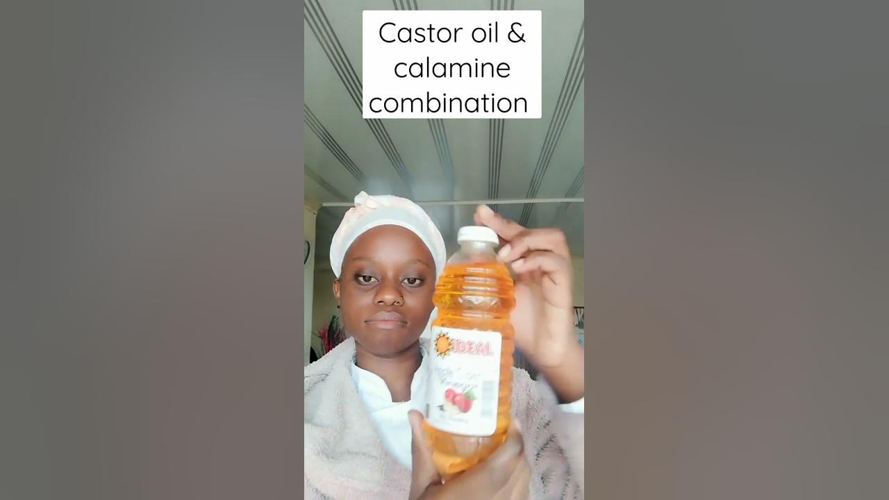castor-oil-and-calamine-lotion-for-dark-spots-must-watch-itshlengy