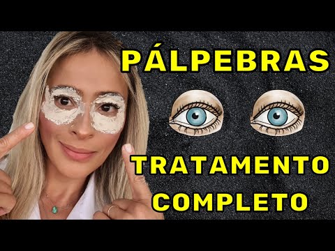 PÁLPEBRAS INCHADAS, CAÍDAS, ESCURAS, COM GORDURAS? RESOLVA ESTES PROBLEMAS! TRATAMENTO COMPLETO!