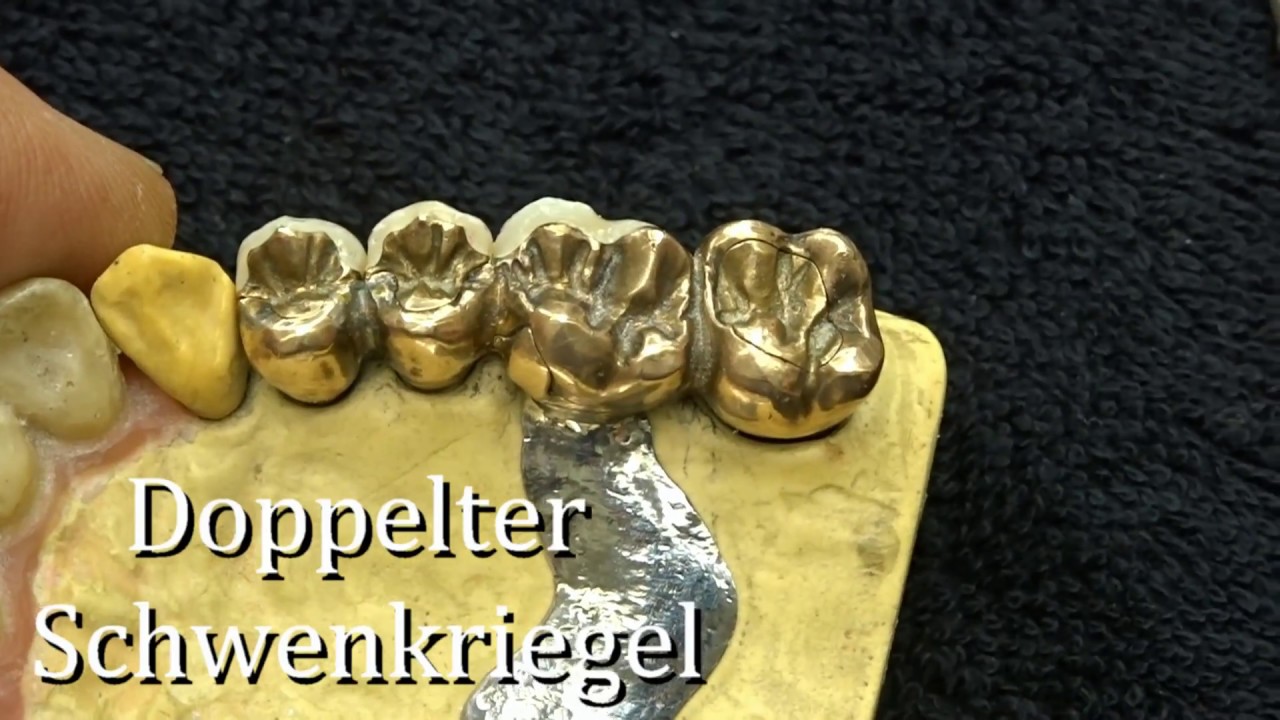Doppelter Schwenkriegel