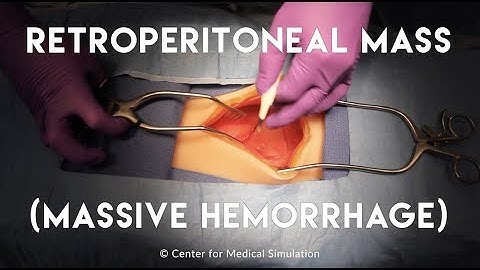 Moulage 101: Retroperitoneal Mass with Massive Hemorrhage | Mad Simulationist