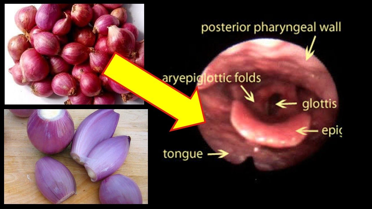 சின்ன வெங்காயம் சாப்பிடும் ஒவ்வொருவரும் அவசியம் பார்க்கவேண்டியது