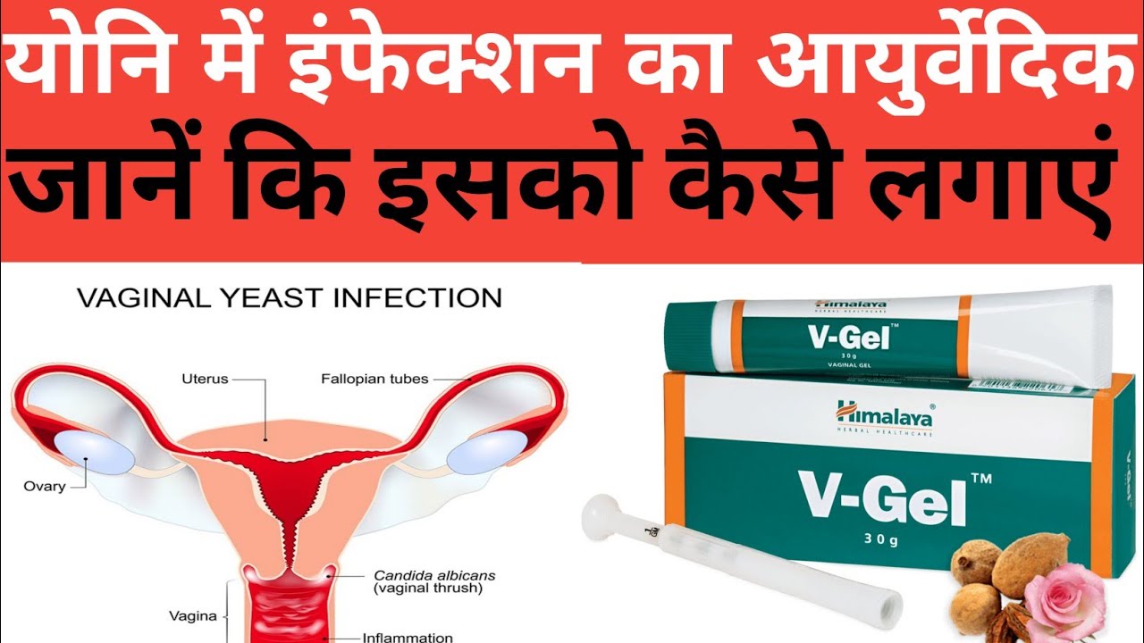 Himalaya V gel review in Hindi/himalaya V gel benifits/v gel how to use/dose/side effects YouTube