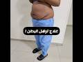 شفط دهون البطن عند السيدات د محمد الهيتمى شفط دهون البطن عند السيدات د محمد الهيتمى