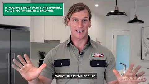 First Aid Tips: Burns & Scalds