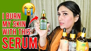 i Burn My Skin with Serum | Use Serum According Your Skin type | how to use a serum for face