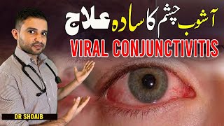 Viral Conjunctivitis Explained By Dr Shoaib In Urduhindi
