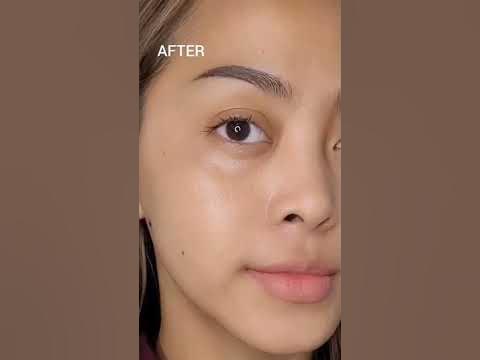 SERUM VIRAL ATASI FLEK HITAM DAN PERBAIKI SKIN BARRIER + 10%