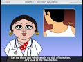 Teachaids english  india hiv prevention tutorial  female version