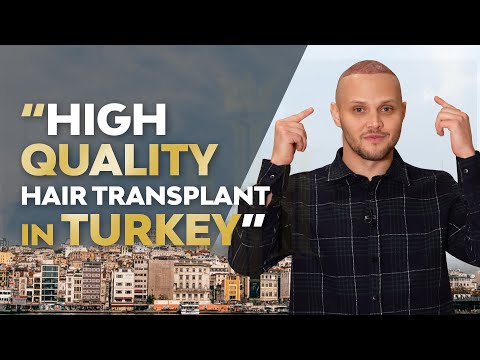 Vídeo: Alexander Pryanikov teve cabelo transplantado