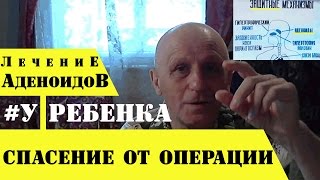 Аденоиды ЛЕЧЕНИЕ, КОТОРОЕ СПАСЕТ РЕБЕНКА ОТ ОПЕРАЦИИ Аденоиды ЛЕЧЕНИЕ, КОТОРОЕ СПАСЕТ РЕБЕНКА ОТ ОПЕРАЦИИ