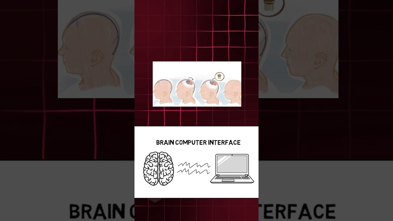 NEURALINK IN ASSAMESE I FUTURE OF TECHNOLOGY 