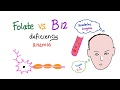 Folate Deficiency Vs Vitamin B12 Deficiency