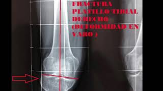 Ruben Sosa Arauco-6