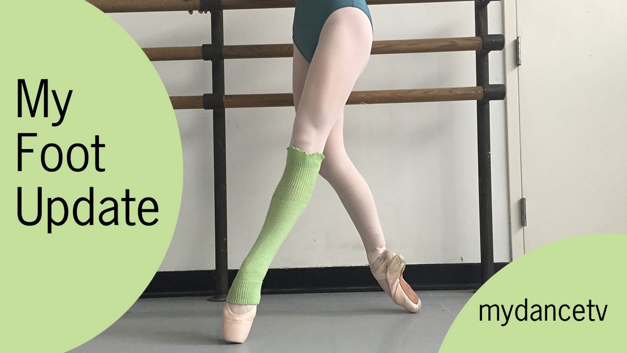 Ballet Foot Injury Update - I Was Out for Weeks! - YouTube