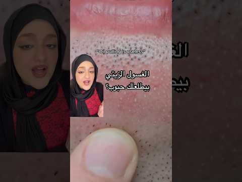 ليه الغسول الزيتي بيطلعلك حبوب