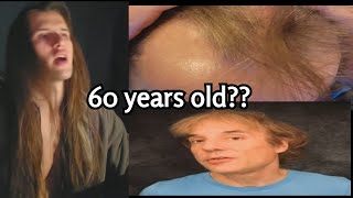 Bro reversed his hair loss NATURALLY after DECADES.